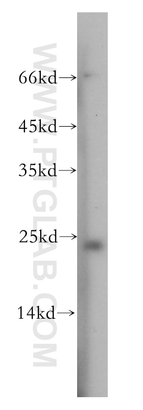 Western Blot (WB) analysis of Y79 cells using Recoverin Polyclonal antibody (10073-1-AP)