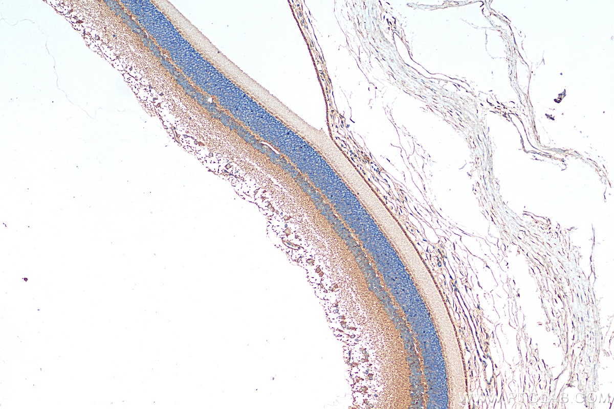 Immunohistochemistry (IHC) staining of rat eye tissue using RD3 Polyclonal antibody (14855-1-AP)