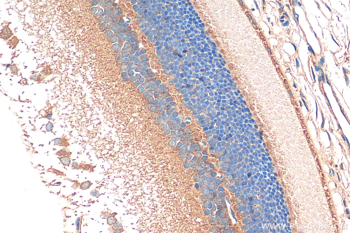 Immunohistochemistry (IHC) staining of rat eye tissue using RD3 Polyclonal antibody (14855-1-AP)