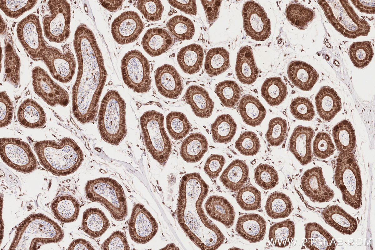 IHC staining of mouse epididymis using 14855-1-AP Immunohistochemistry (IHC) staining of mouse epididymis tissue using RD3 Polyclonal antibody (14855-1-AP)