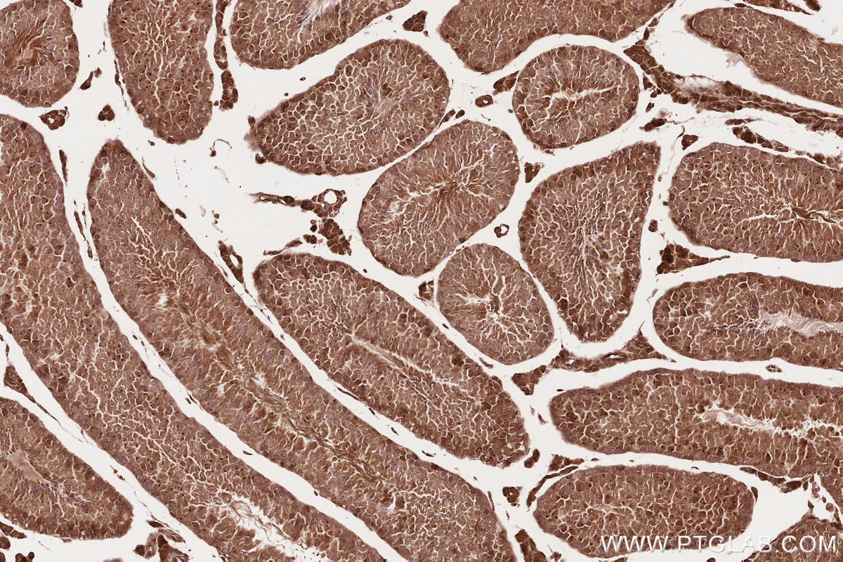 IHC staining of mouse testis using 14855-1-AP Immunohistochemistry (IHC) staining of mouse testis tissue using RD3 Polyclonal antibody (14855-1-AP)