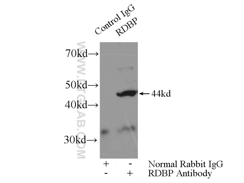 Immunoprecipitation (IP) experiment of mouse brain tissue using NELFE Polyclonal antibody (10705-1-AP)