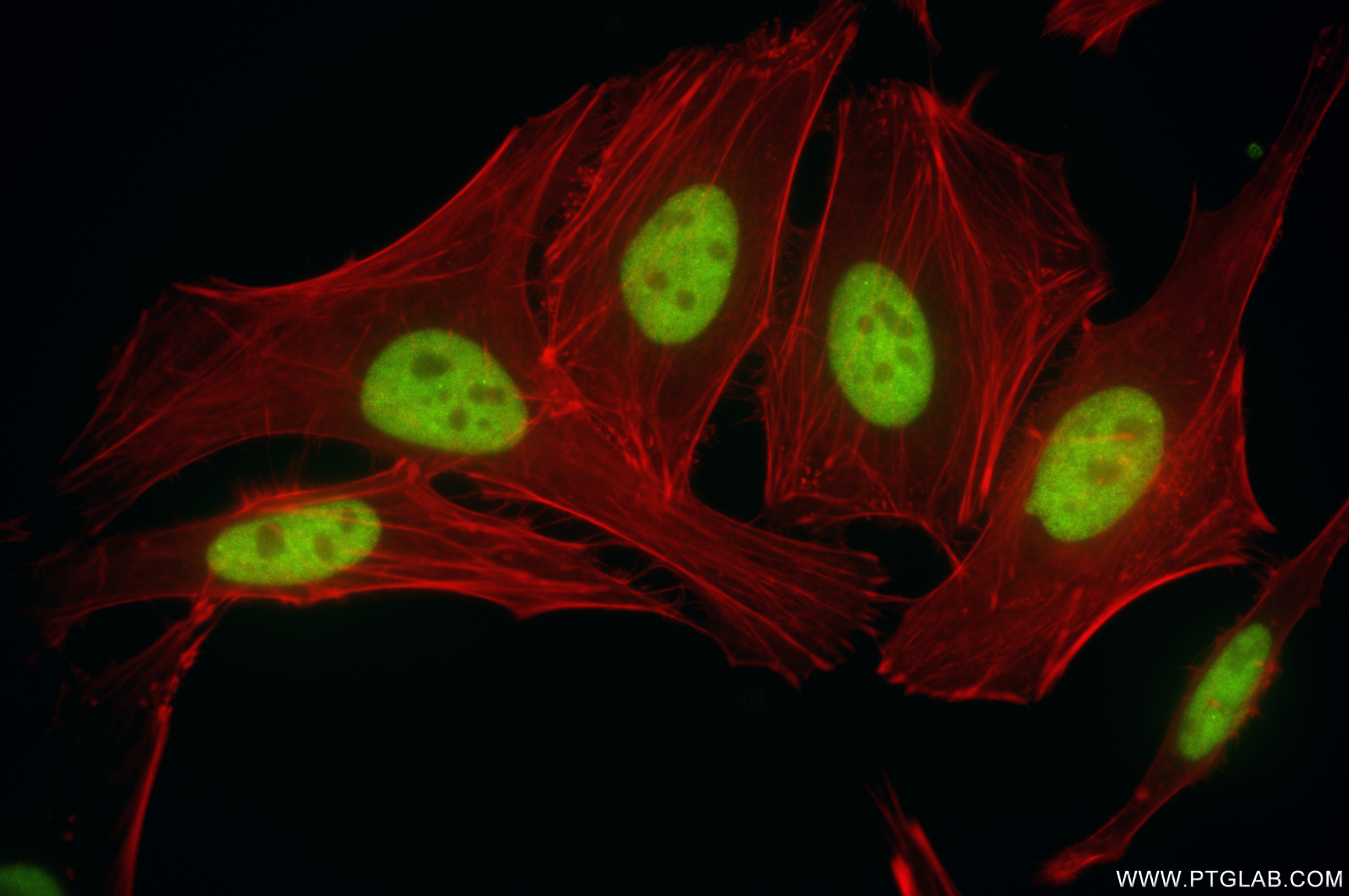 Immunofluorescence (IF) / fluorescent staining of HeLa cells using RDBP Recombinant antibody (85945-1-RR)