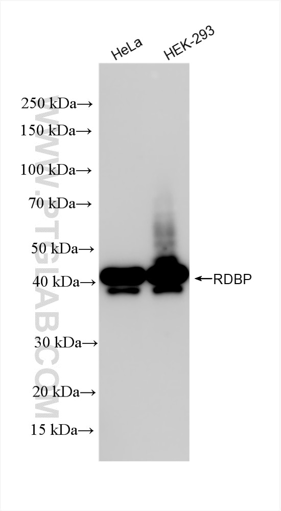 Western Blot (WB) analysis of various lysates using RDBP Recombinant antibody (85945-1-RR)