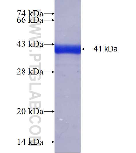 RDBP fusion protein Ag18350 SDS-PAGE