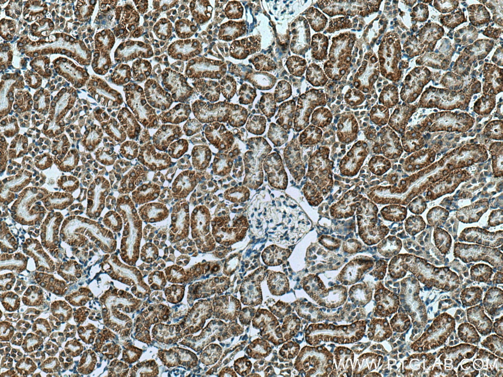 Immunohistochemistry (IHC) staining of mouse kidney tissue using RDH10 Polyclonal antibody (14644-1-AP)