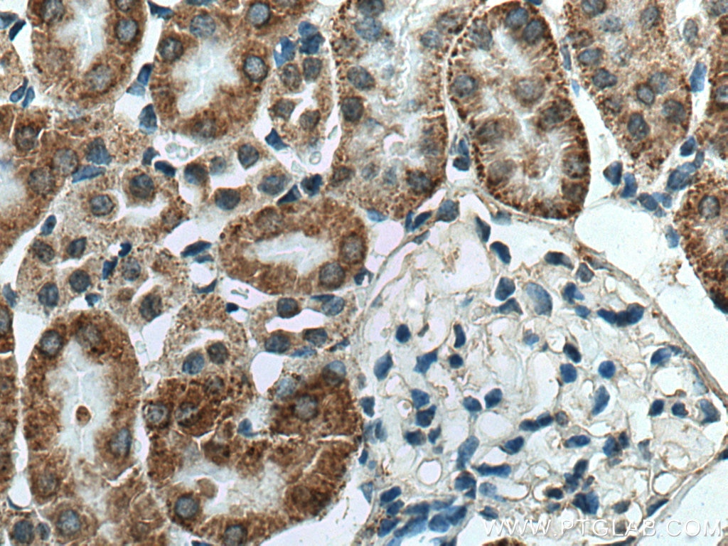 Immunohistochemistry (IHC) staining of mouse kidney tissue using RDH10 Polyclonal antibody (14644-1-AP)
