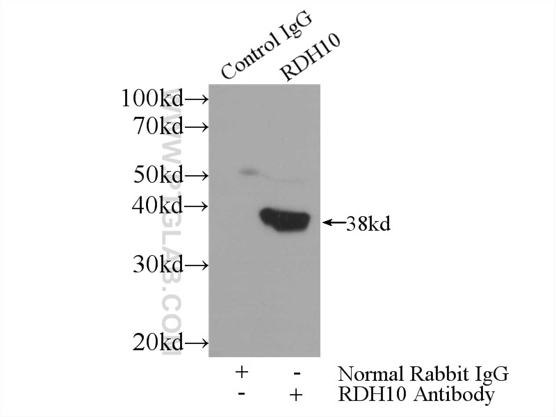 Immunoprecipitation (IP) experiment of mouse liver tissue using RDH10 Polyclonal antibody (14644-1-AP)