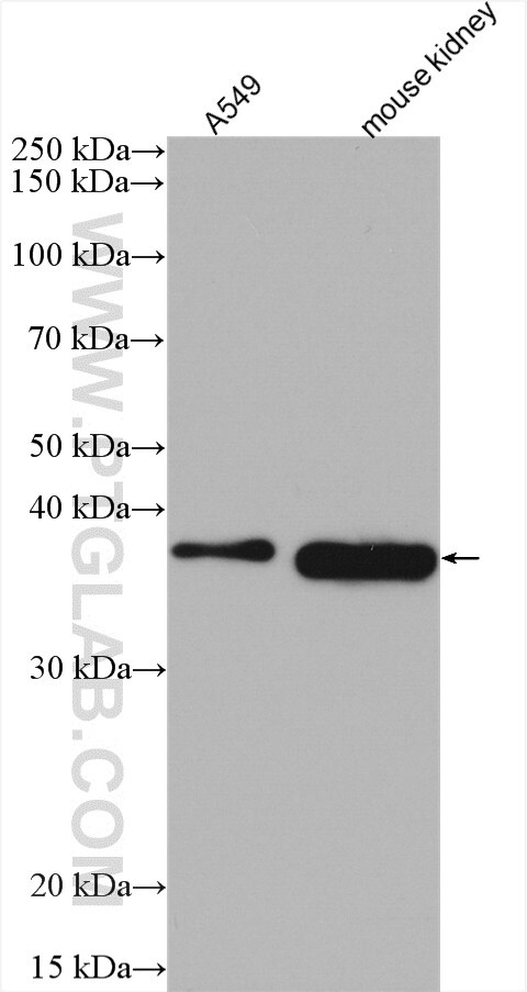 Western Blot (WB) analysis of various lysates using RDH10 Polyclonal antibody (14644-1-AP)