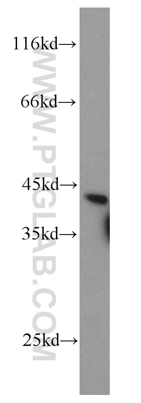 RDH10 Polyclonal antibody