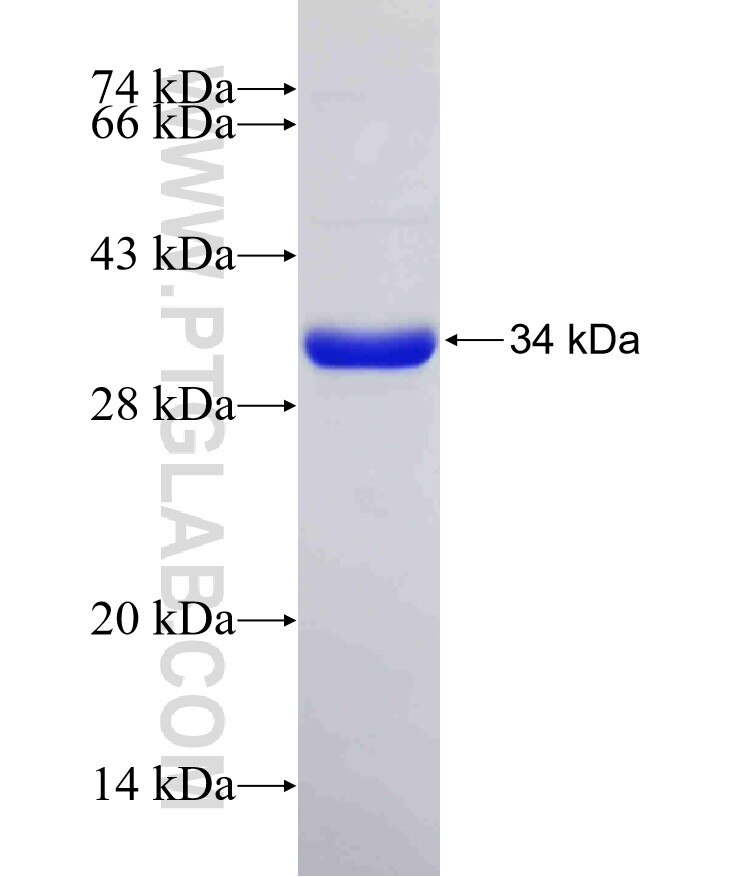 RDH10 fusion protein Ag6295 SDS-PAGE