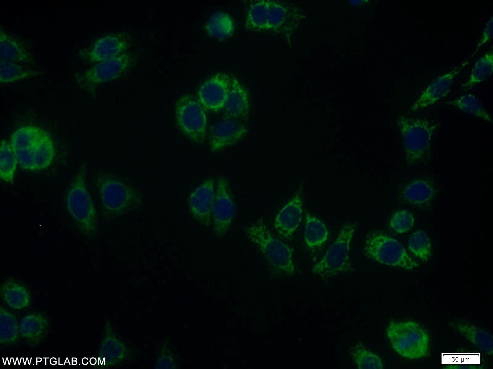 IF Staining of PC-3 using 11077-1-AP