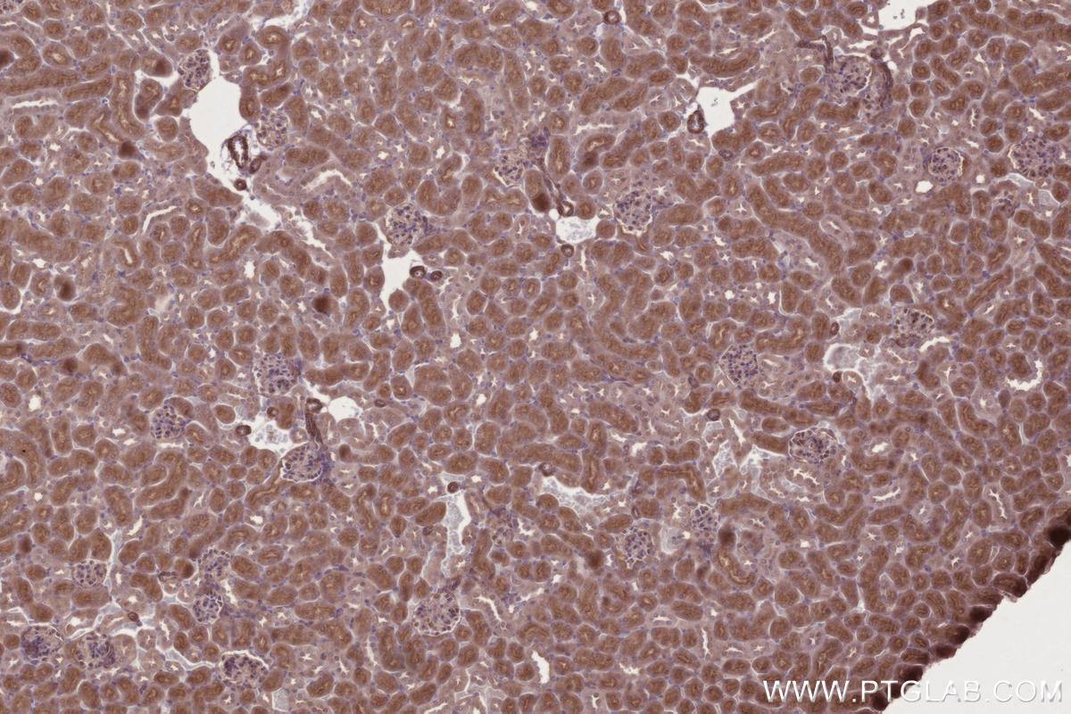 Immunohistochemistry (IHC) staining of mouse kidney tissue using RDH11 Polyclonal antibody (11077-1-AP)
