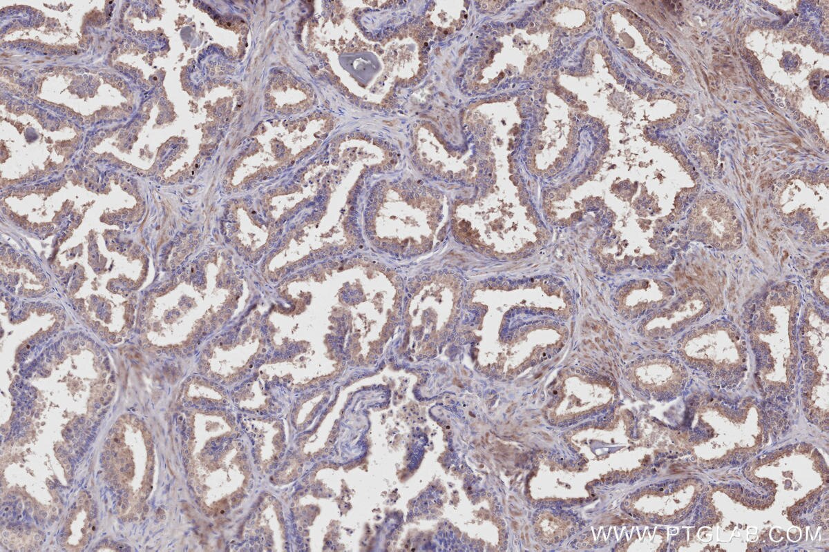 Immunohistochemistry (IHC) staining of human prostate hyperplasia tissue using RDH11 Polyclonal antibody (11077-1-AP)