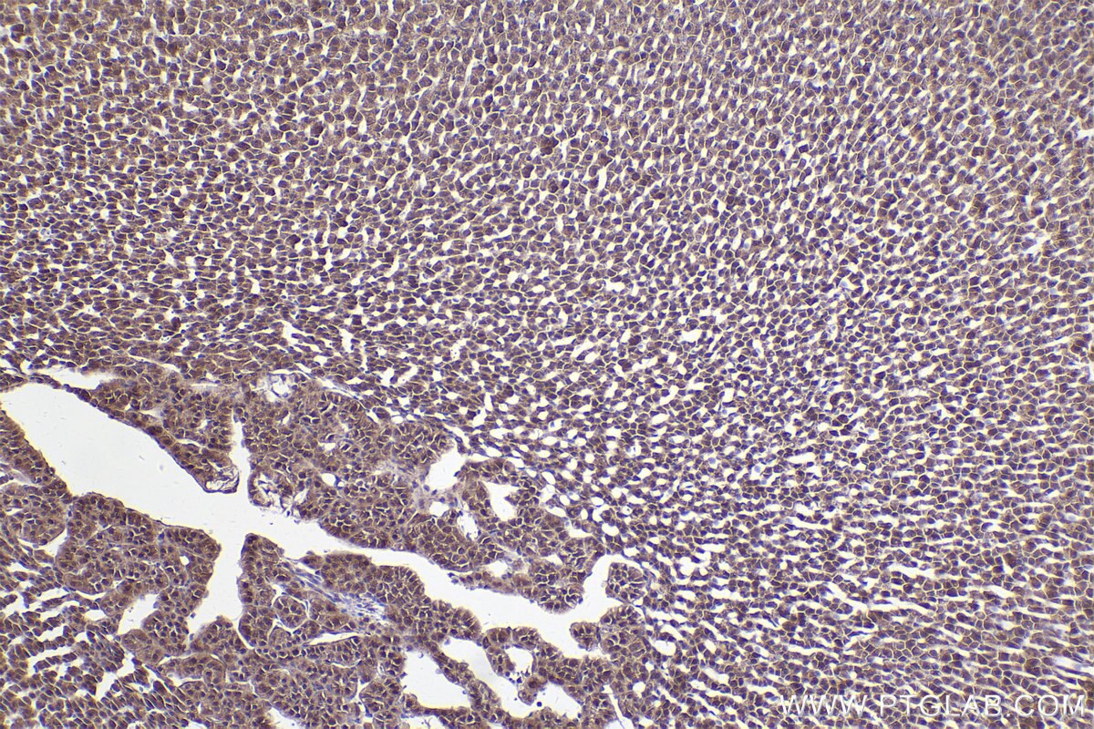 Immunohistochemistry (IHC) staining of rat adrenal gland tissue using RDH11 Polyclonal antibody (11077-1-AP)