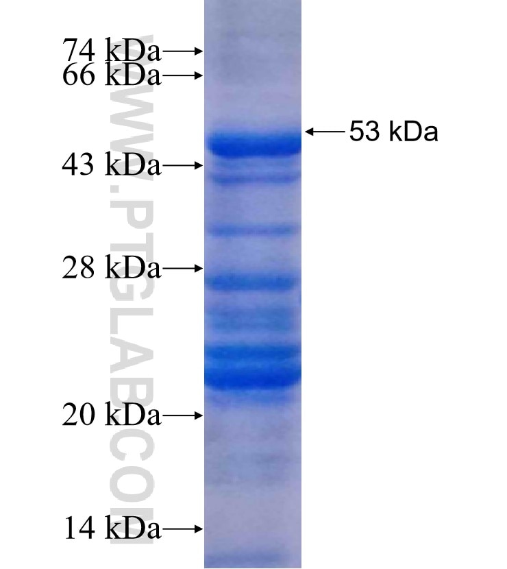 RDH11 fusion protein Ag1485 SDS-PAGE