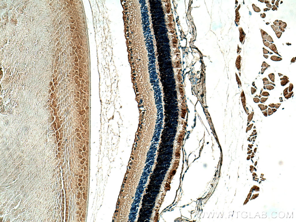 IHC staining of mouse eye using 13289-3-AP