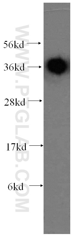 Western Blot (WB) analysis of human heart tissue using RDH13 Polyclonal antibody (16067-1-AP)