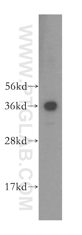 Western Blot (WB) analysis of Y79 cells using RDH13 Polyclonal antibody (16067-1-AP)
