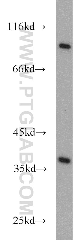 Western Blot (WB) analysis of A549 cells using RDH14 Polyclonal antibody (16283-1-AP)