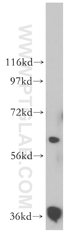 Western Blot (WB) analysis of human heart tissue using RDH14 Polyclonal antibody (16283-1-AP)
