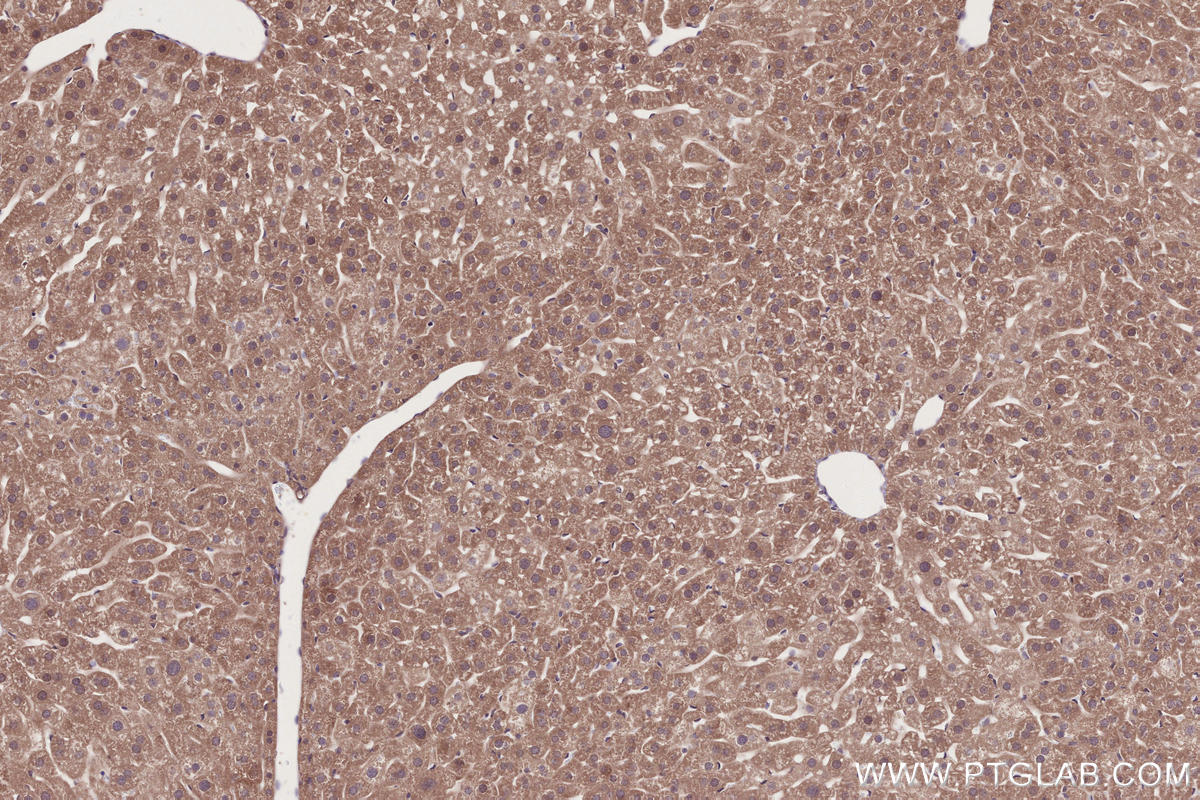 IHC staining of mouse liver using 13140-1-AP Immunohistochemistry (IHC) staining of mouse liver tissue using RDH5 Polyclonal antibody (13140-1-AP)