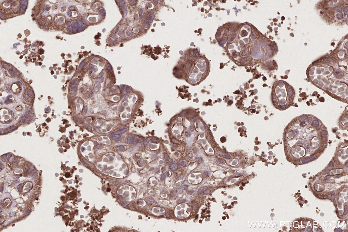 IHC staining of human placenta using 13140-1-AP Immunohistochemistry (IHC) staining of human placenta tissue using RDH5 Polyclonal antibody (13140-1-AP)