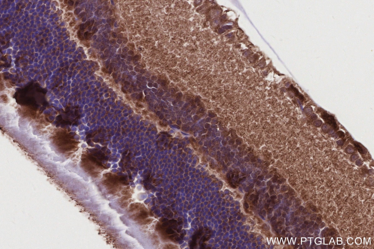 IHC staining of mouse eye using 13140-1-AP Immunohistochemistry (IHC) staining of mouse eye tissue using RDH5 Polyclonal antibody (13140-1-AP)