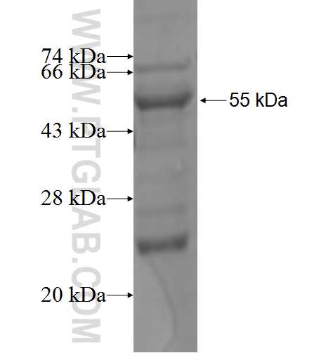 RDH5 fusion protein Ag3784 SDS-PAGE