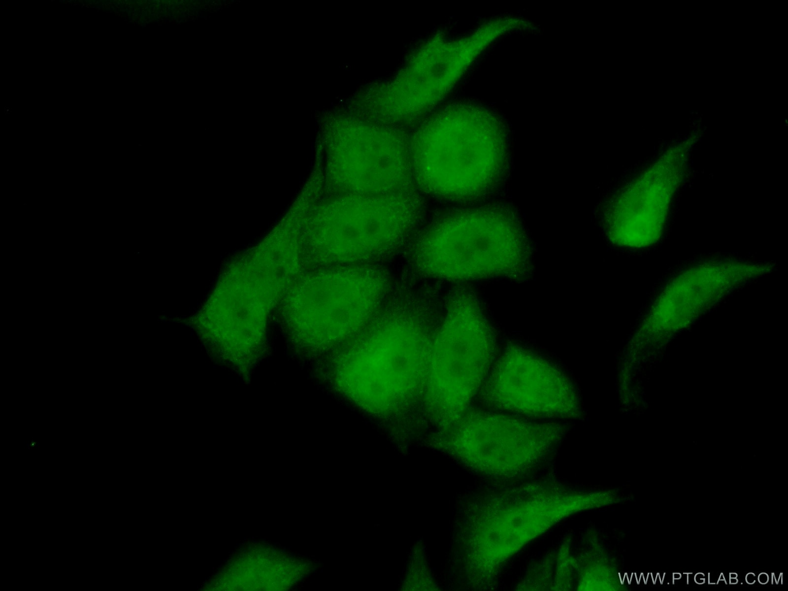 Immunofluorescence (IF) / fluorescent staining of PC-3 cells using RDM1 Polyclonal antibody (20156-1-AP)