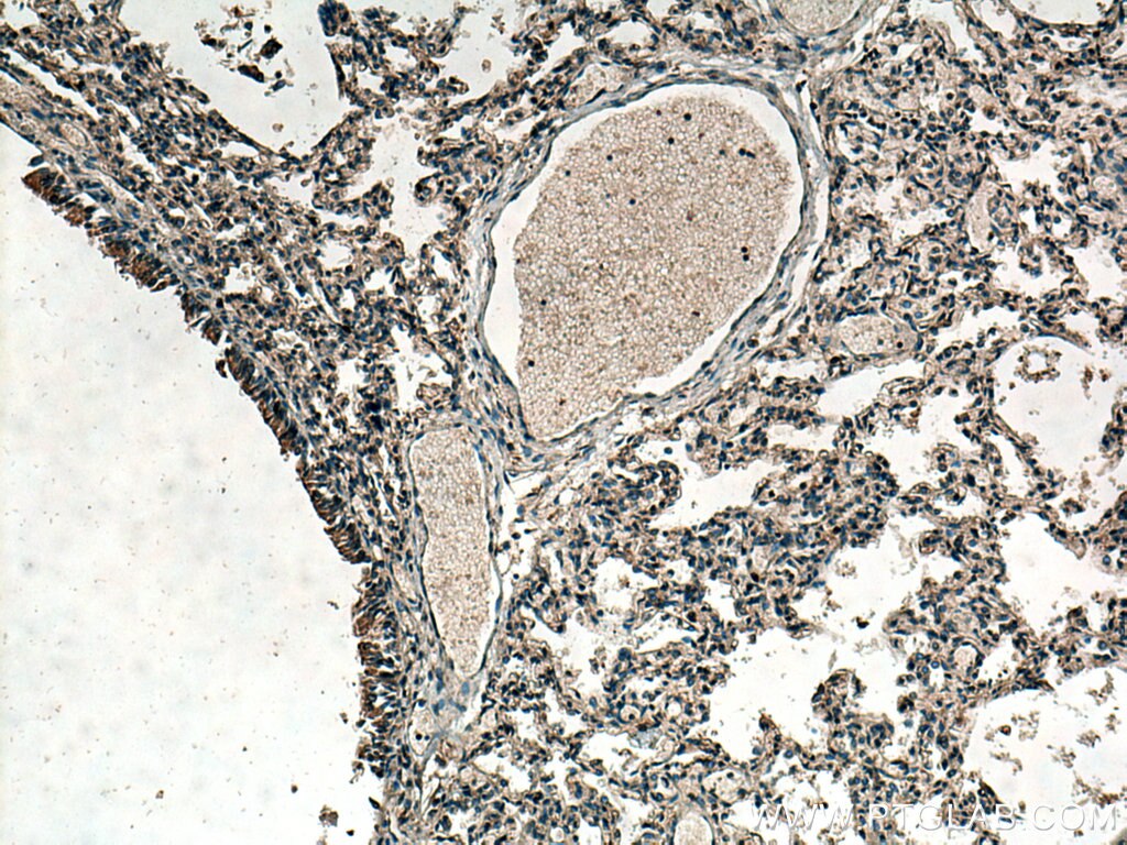 Immunohistochemistry (IHC) staining of human lung tissue using RDM1 Polyclonal antibody (20156-1-AP)