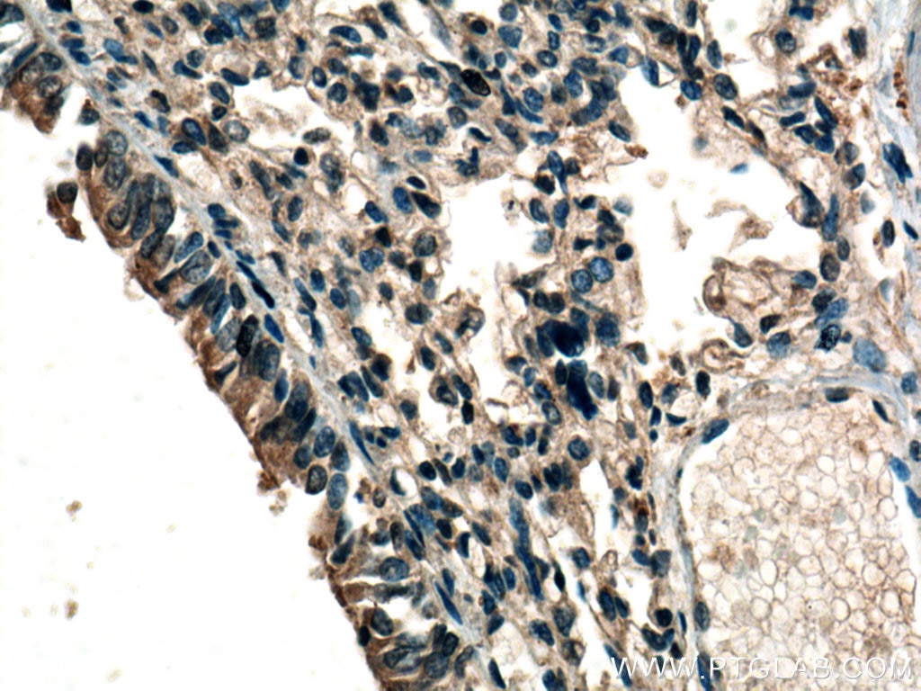 Immunohistochemistry (IHC) staining of human lung tissue using RDM1 Polyclonal antibody (20156-1-AP)