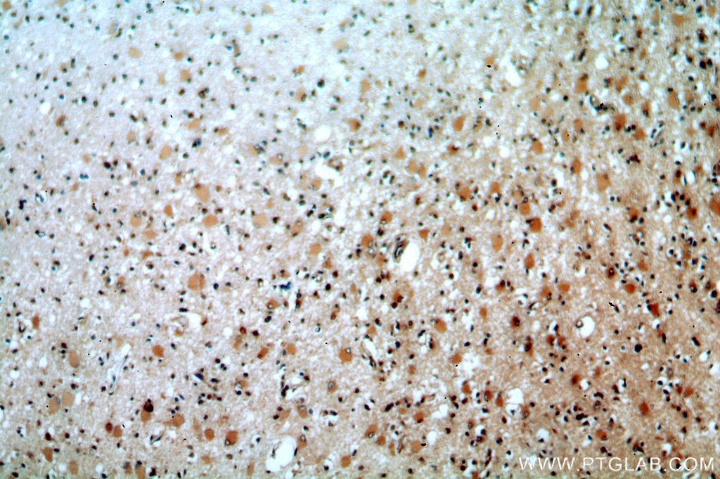 Immunohistochemistry (IHC) staining of human brain tissue using RDM1 Polyclonal antibody (20156-1-AP)