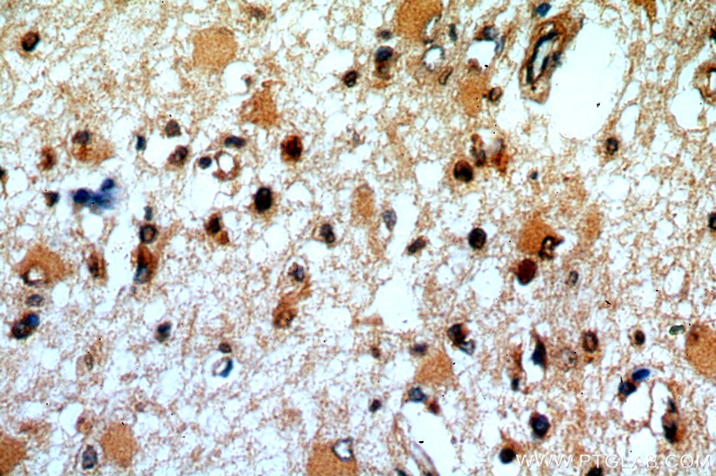Immunohistochemistry (IHC) staining of human brain tissue using RDM1 Polyclonal antibody (20156-1-AP)