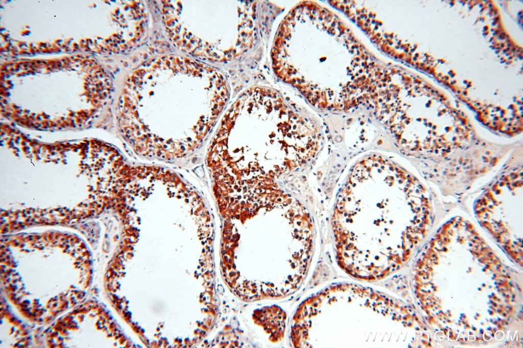 Immunohistochemistry (IHC) staining of human testis tissue using RDM1 Polyclonal antibody (20156-1-AP)