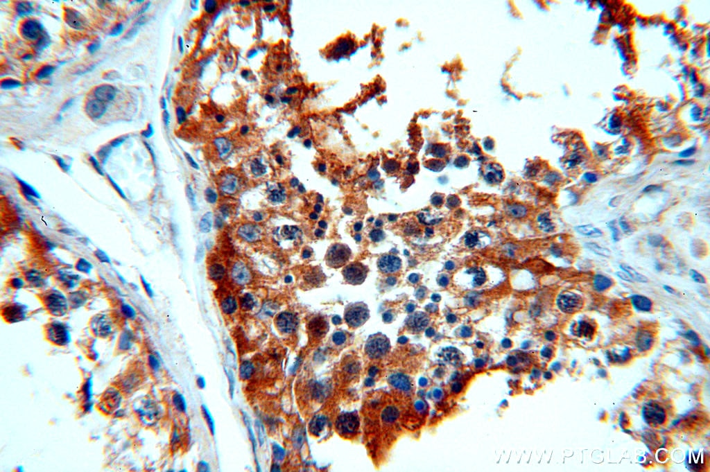 Immunohistochemistry (IHC) staining of human testis tissue using RDM1 Polyclonal antibody (20156-1-AP)