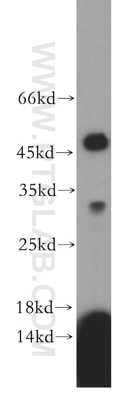 Western Blot (WB) analysis of MCF-7 cells using RDM1 Polyclonal antibody (20156-1-AP)