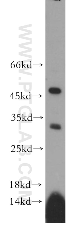 Western Blot (WB) analysis of PC-3 cells using RDM1 Polyclonal antibody (20156-1-AP)