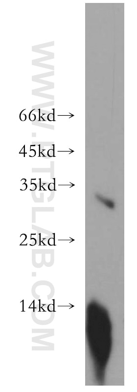 Western Blot (WB) analysis of human placenta tissue using RDM1 Polyclonal antibody (20156-1-AP)