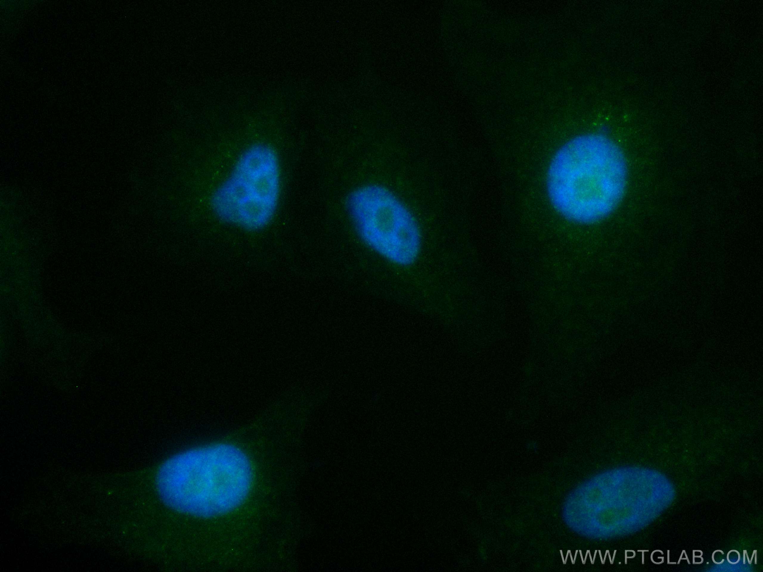 Immunofluorescence (IF) / fluorescent staining of A549 cells using CoraLite® Plus 488-conjugated RDM1 Monoclonal anti (CL488-66941)
