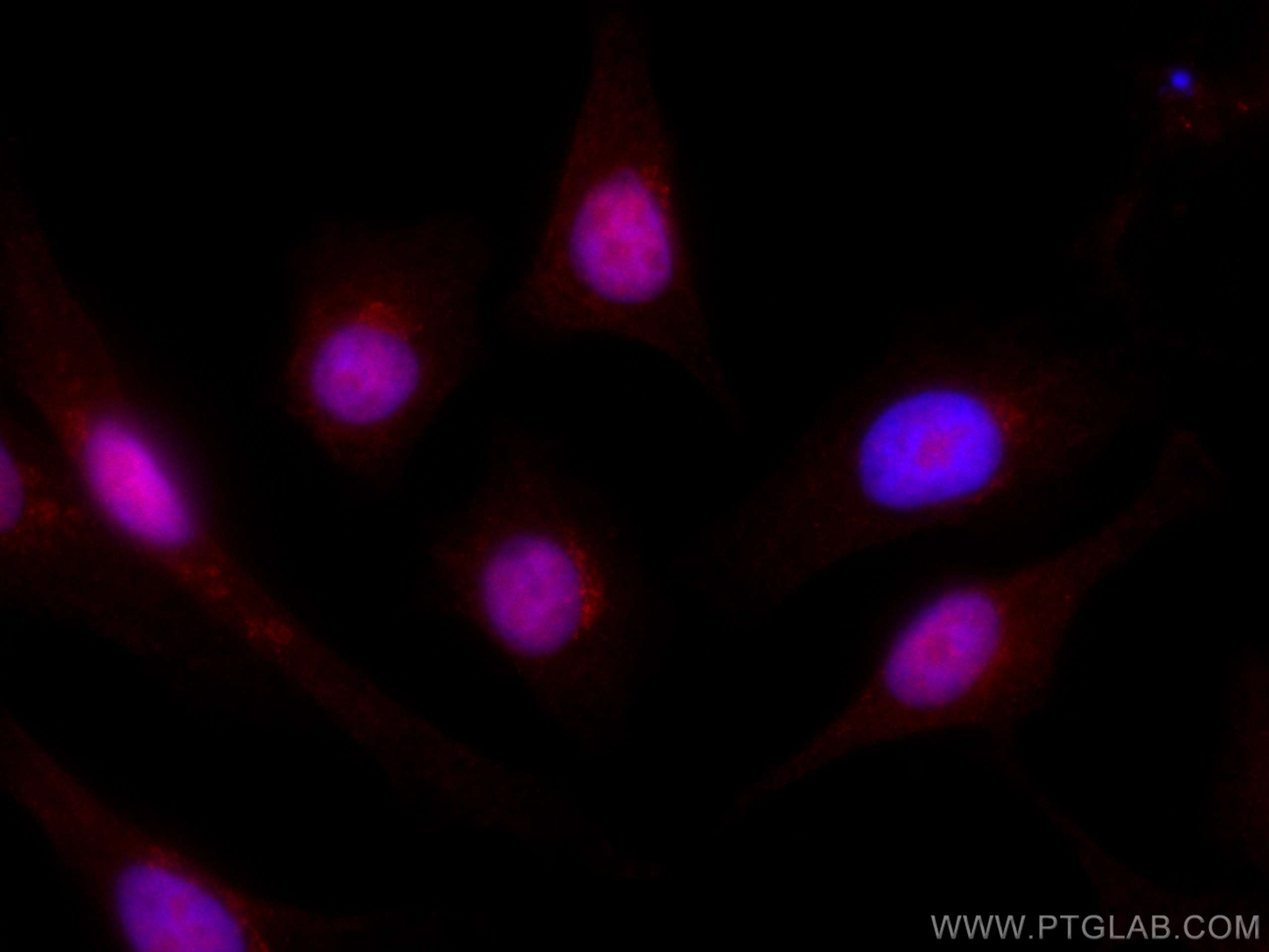 Immunofluorescence (IF) / fluorescent staining of A549 cells using CoraLite®594-conjugated RDM1 Monoclonal antibody (CL594-66941)