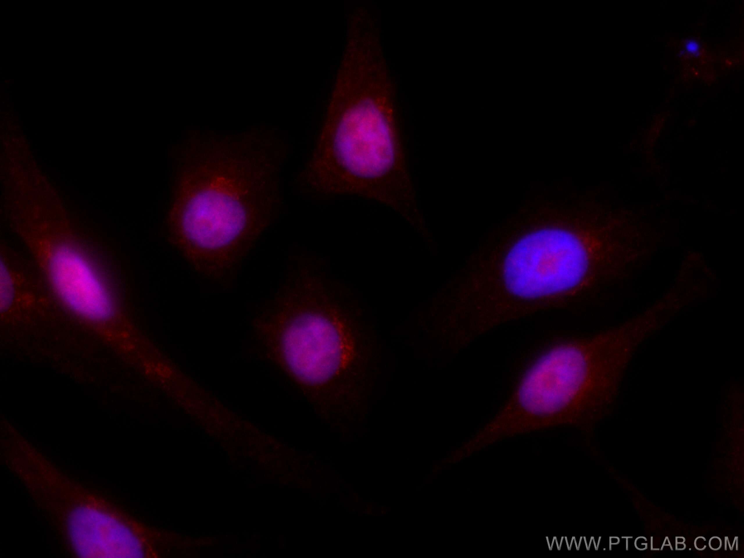 IF Staining of A549 using CL594-66941