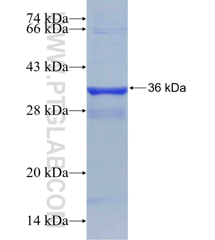 RDM1 fusion protein Ag31134 SDS-PAGE RDM1 fusion protein Ag31134 SDS-PAGE