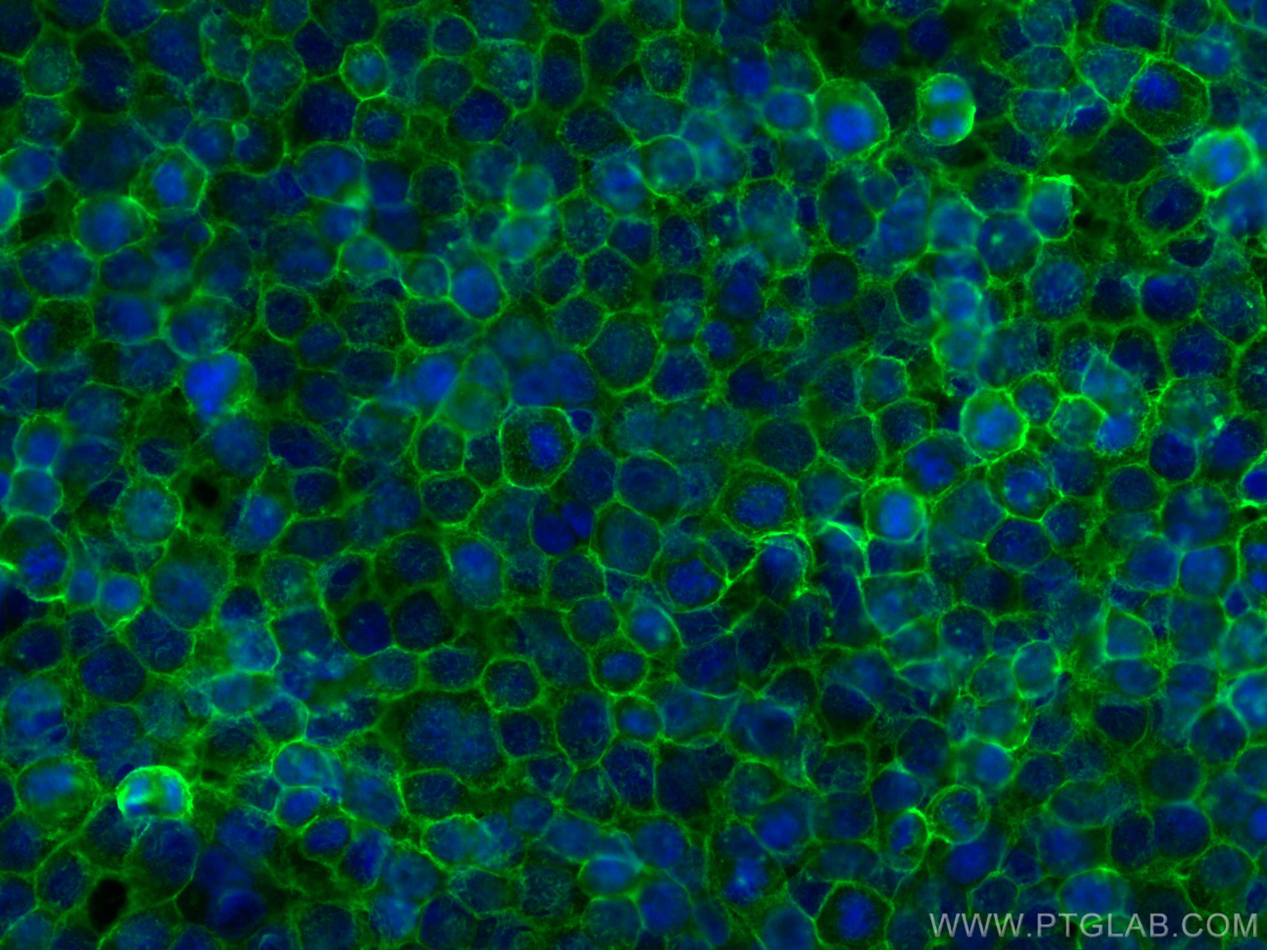 Immunofluorescence (IF) / fluorescent staining of HEK-293 cells using SLC1A5/ASCT2 Polyclonal antibody (20350-1-AP)