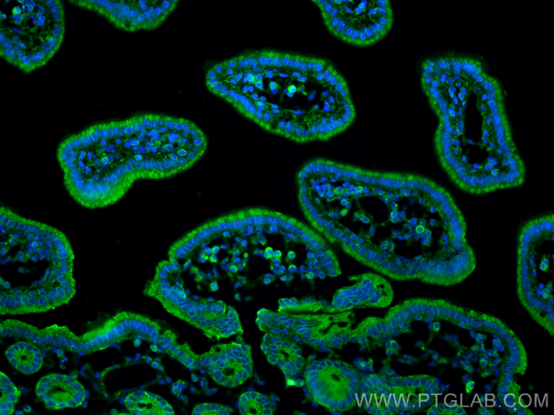 Immunofluorescence (IF) / fluorescent staining of mouse small intestine tissue using SLC1A5/ASCT2 Monoclonal antibody (68540-1-Ig)