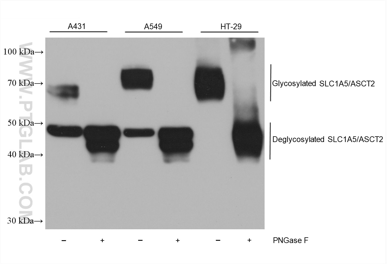 Western Blot (WB) analysis of various lysates using SLC1A5/ASCT2 Monoclonal antibody (68540-1-Ig)