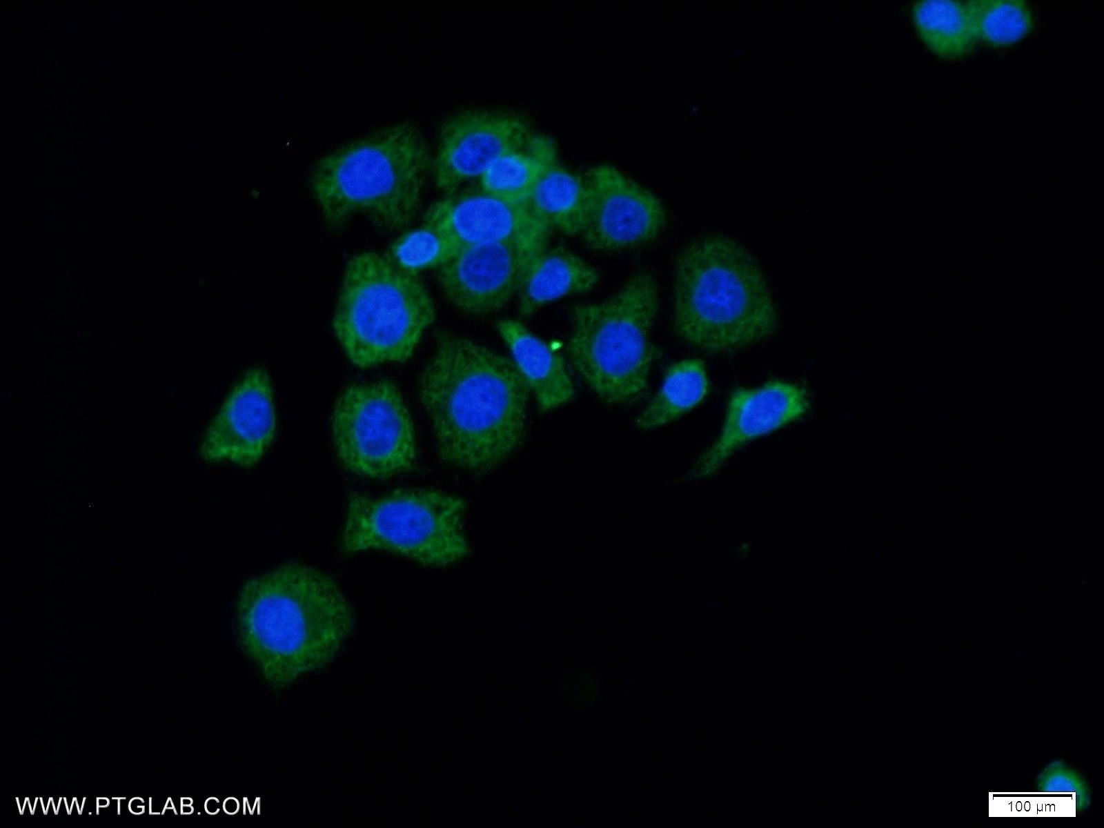 Immunofluorescence (IF) / fluorescent staining of MCF-7 cells using Radixin Polyclonal antibody (13790-1-AP)