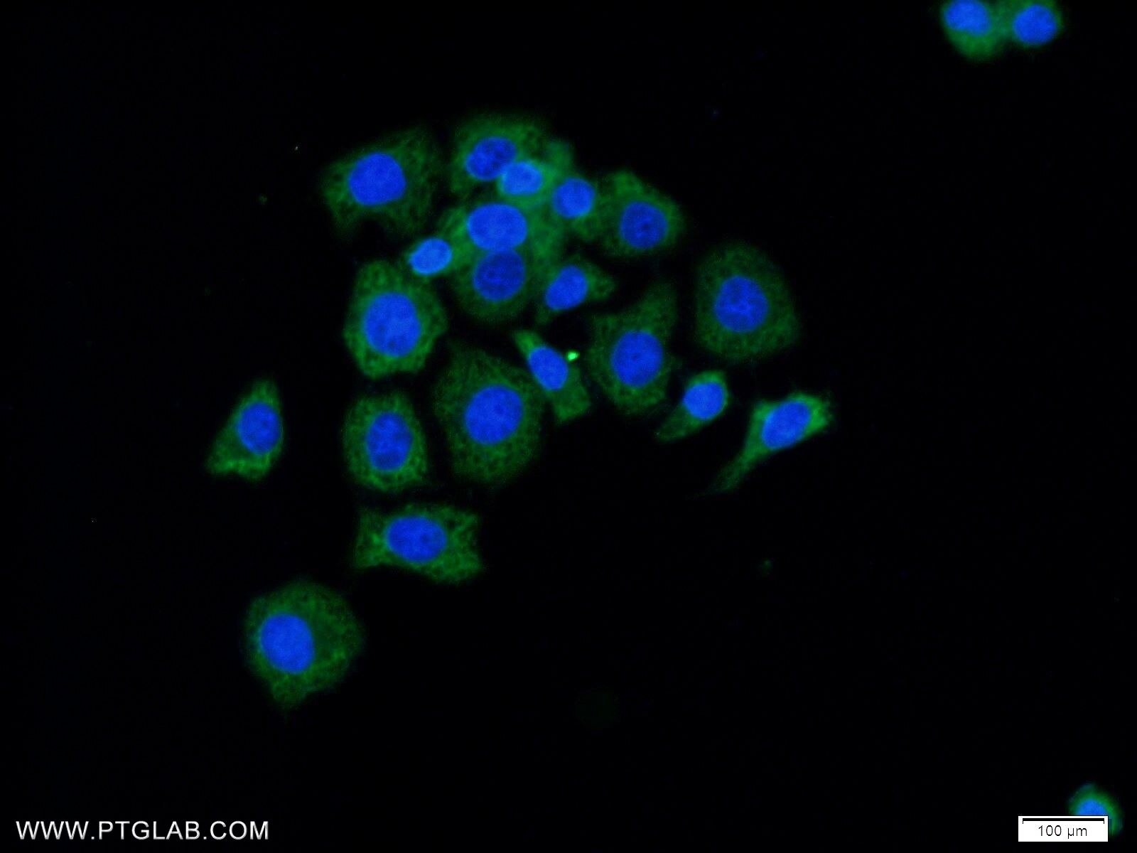 IF Staining of MCF-7 using 13790-1-AP