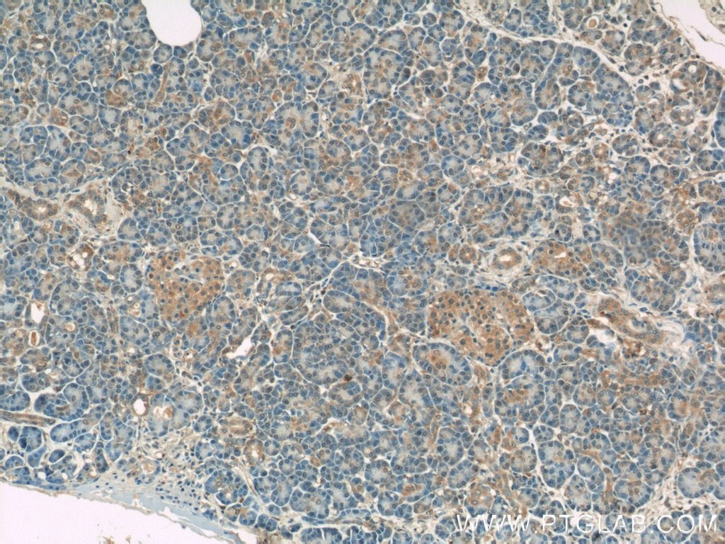 Immunohistochemistry (IHC) staining of human pancreas tissue using Radixin Polyclonal antibody (13790-1-AP)