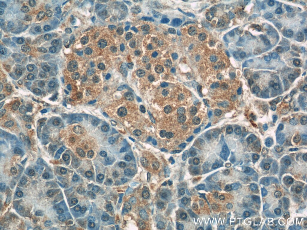 Immunohistochemistry (IHC) staining of human pancreas tissue using Radixin Polyclonal antibody (13790-1-AP)